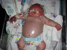 Jane Hansen and the Daily Telegraph-Stop the Smear Campaign and Tell Australian parents the truth for once!