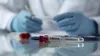 Ebola: la RDC va tester un 2e vaccin
