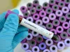 Coronavirus en Afrique de l’Ouest : 26 785 cas au 21 mai 2020