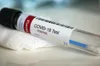 Covid-19 Sénégal : 83 nouveaux cas, pour un total de 3.130