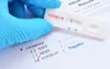 Coronavirus : le point dans le monde au 22 février 2021