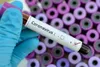 Vaccin COVID-19 en Afrique : l’OMS appelle les pays à se préparer