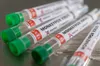 Variole de singe : trois cas au Maroc