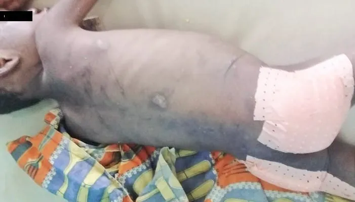 N’Douci : Un instituteur bénévole torture son neveu de 5 ans avec une machette incandescente et prend la fuite