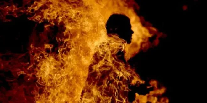 Mankono : un enfant 8 ans sévèrement brûlé alors qu’il se trouvait piégé dans un feu de brousse