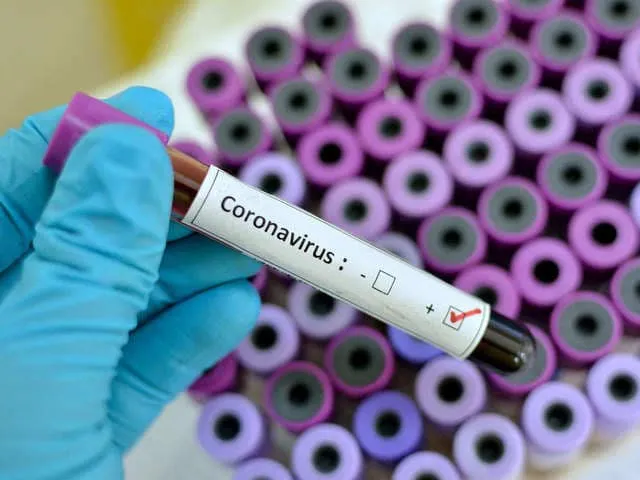 Coronavirus en Afrique de l’Ouest : 26 785 cas au 21 mai 2020