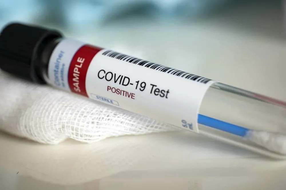 Coronavirus en Côte d’Ivoire : 310 nouveaux cas, soit 11 504 au total au 8 juillet 2020