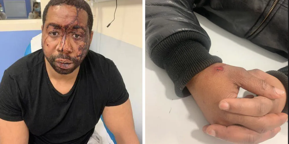 Affaire Michel Zécler : 4 policiers en garde à vue après avoir tabassé le producteur noir