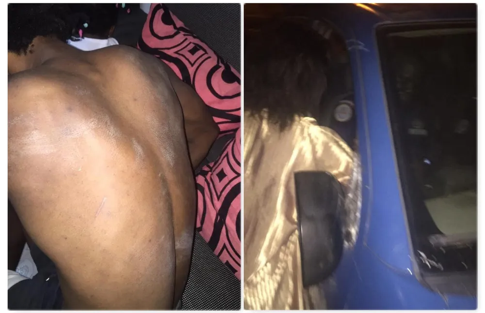 Cocody : un capitaine de la gendarmerie bat la femme nourrice d’un international ivoirien et l’envoie à l’hôpital