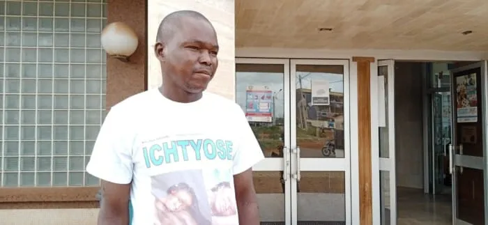 Les malades de l’ichtyose appelés à surmonter ce handicap – Actualité ivoirienne 03/03/2021