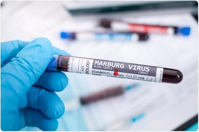 Ghana : fin de l’épidémie de maladie à virus Marburg