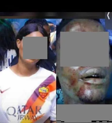 Soubré : elle tranche la gorge du DJ à l’aide d’une bouteille au cours d’une altercation