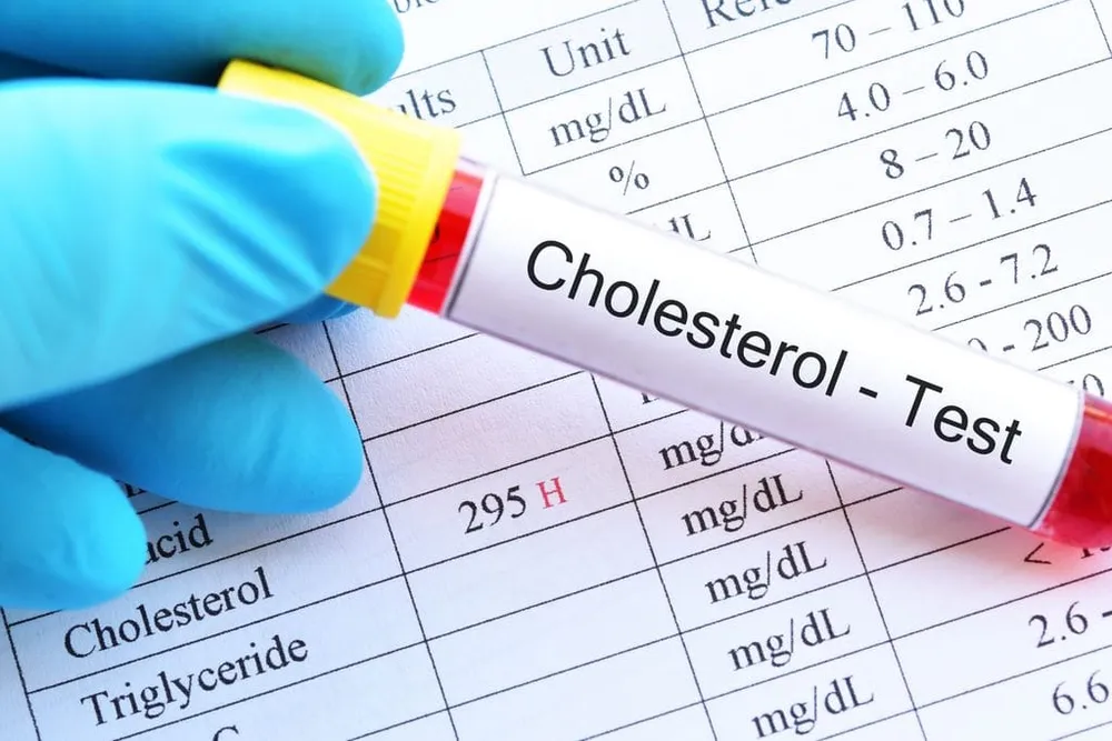 Taux cholestérol