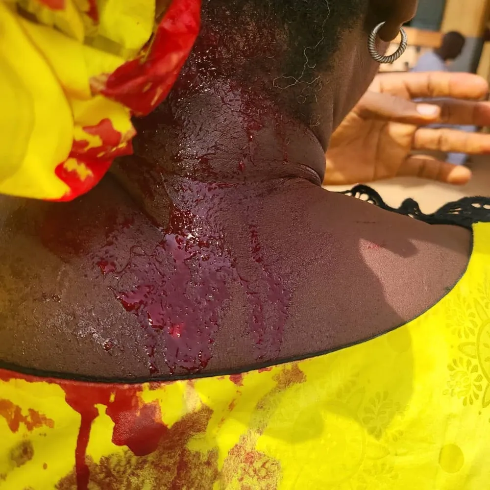 BAC 2023 en Guinée : une directrice de centre agressée pour sa rigueur dans la surveillance