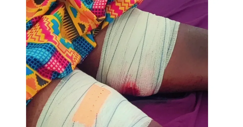 Les jambes de la victime lors du braquage à Alépé