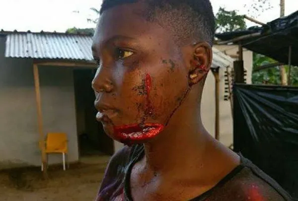 San Pédro : Piqué par la jalousie, il tue son ami, viole sa copine et tente de la tuer