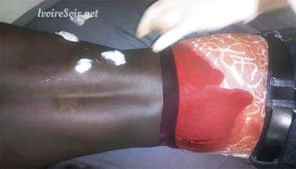 Affrontement Bouaké