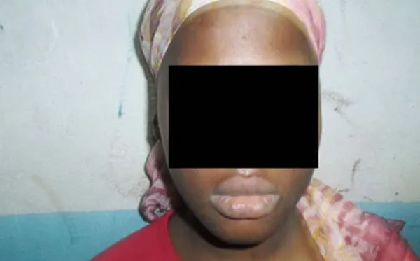 Djatodouo: il enlève une fille 9 ans pour une union matrimoniale