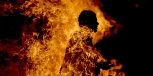 Mankono : un enfant 8 ans sévèrement brûlé alors qu’il se trouvait piégé dans un feu de brousse