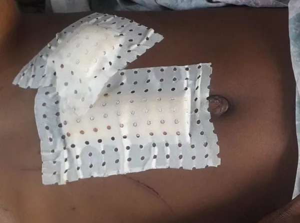 Vavoua : il poignarde sa petite amie qu’il soupçonne d’infidélité et tente de se suicider