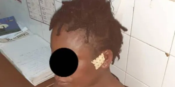 Botro : une femme battue pour avoir demandé à son copain de surseoir à un coup de fil de sa maîtresse