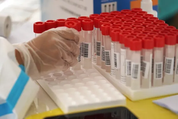 (COVID-19) Plus de huit millions de personnes soumises à un test d’acide nucléique à Beijing – Actualités 28/06/2020
