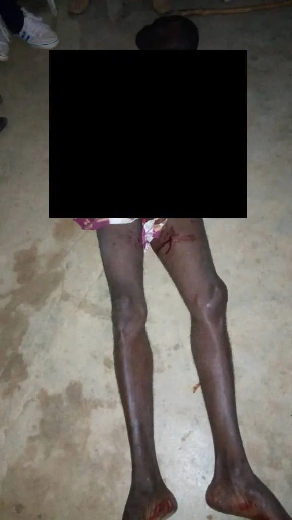Affrontement entre des jeunes d’un village de Daloa : un blessé, des préaux et une maison incendiés – Actualité ivoirienne 06/07/2020