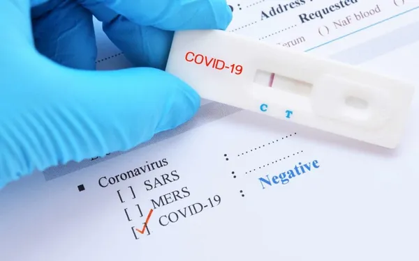 Coronavirus : le point dans le monde au 22 février 2021