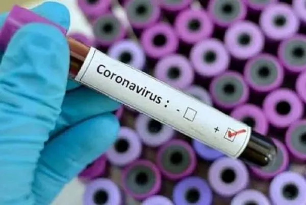 Vaccin COVID-19 en Afrique : l’OMS appelle les pays à se préparer
