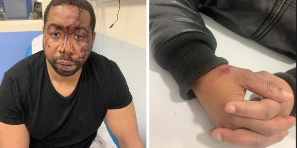 Affaire Michel Zécler : 4 policiers en garde à vue après avoir tabassé le producteur noir
