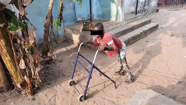 JIPH 2020 : le CNDH relève les droits des personnes en situation de handicap