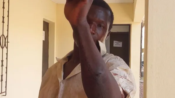Bouna : un agriculteur tailladé à la machette par un bouvier, voici les faits