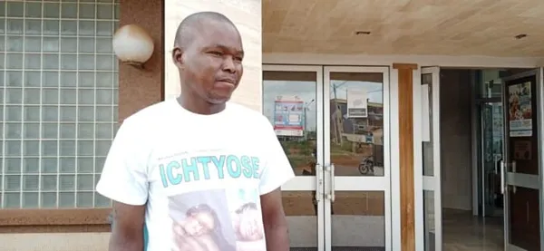 Les malades de l’ichtyose appelés à surmonter ce handicap – Actualité ivoirienne 03/03/2021