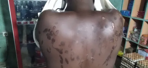 N’Douci : une fille de 15 ans séquestrée pendant 4 jours, torturée et violée