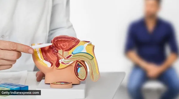 Astuce Santé: Peut-on stopper le grossissement de la prostate ? Tout savoir