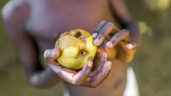 Insécurité alimentaire