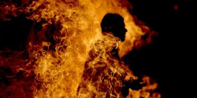 Mankono : un enfant 8 ans sévèrement brûlé alors qu’il se trouvait piégé dans un feu de brousse