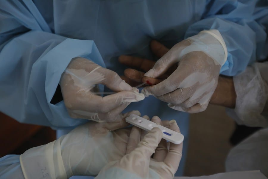Le nombre de décès dus au COVID-19 dans le monde dépasse les 540.000 (université Johns Hopkins) – Actualités 08/07/2020